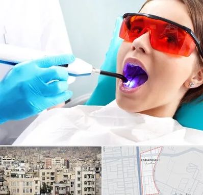 جراحی لثه با لیزر در اسکندری