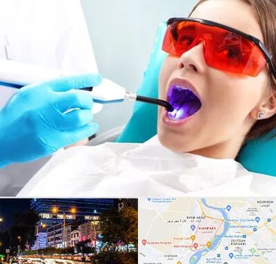 جراحی لثه با لیزر در کیانپارس اهواز