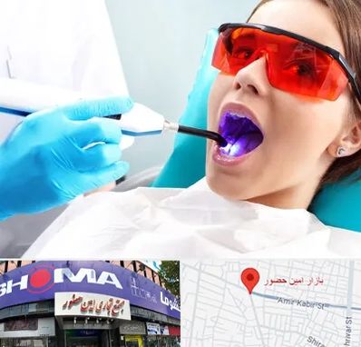 جراحی لثه با لیزر در امین حضور