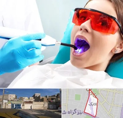 جراحی لثه با لیزر در اتابک