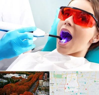 جراحی لثه با لیزر در منطقه 6 تهران