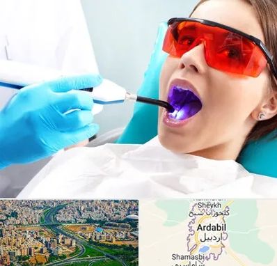 جراحی لثه با لیزر در اردبیل