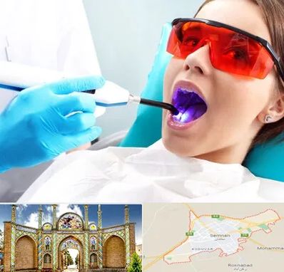 جراحی لثه با لیزر در سمنان