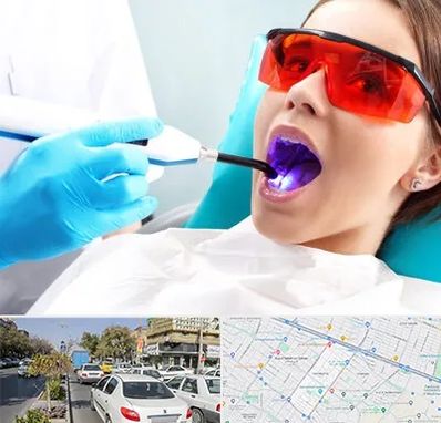 جراحی لثه با لیزر در مفتح مشهد