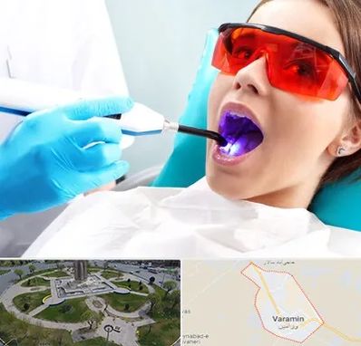 جراحی لثه با لیزر در ورامین