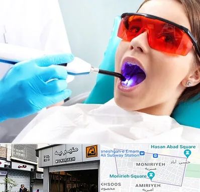 جراحی لثه با لیزر در منیریه 