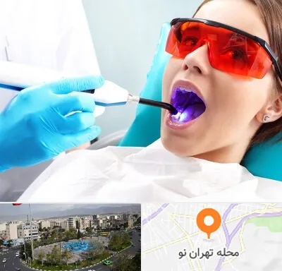 جراحی لثه با لیزر در تهران نو