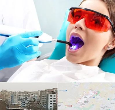 جراحی لثه با لیزر در محمد شهر کرج