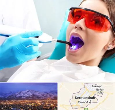 جراحی لثه با لیزر در کرمانشاه