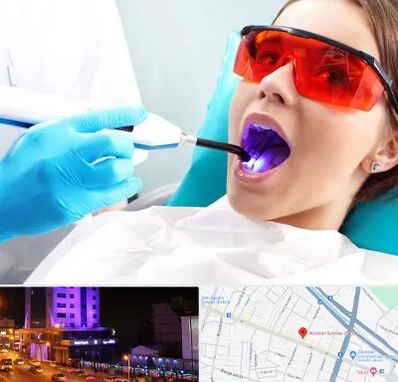 جراحی لثه با لیزر در آبرسان تبریز