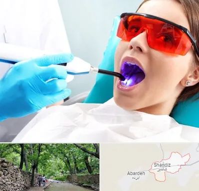 جراحی لثه با لیزر در شاندیز مشهد