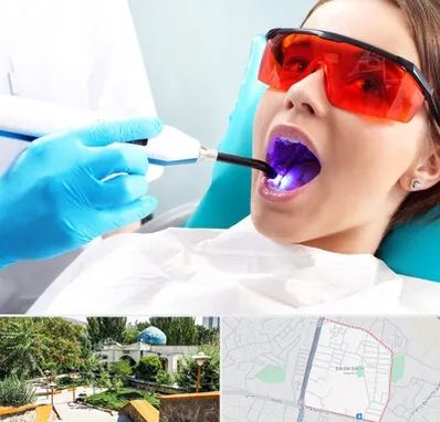 جراحی لثه با لیزر در باغمیشه تبریز