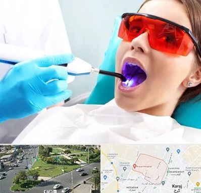 جراحی لثه با لیزر در شاهین ویلا کرج