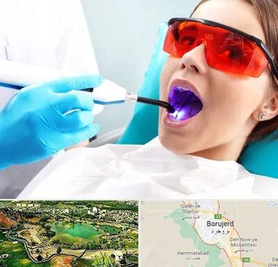 جراحی لثه با لیزر در بروجرد