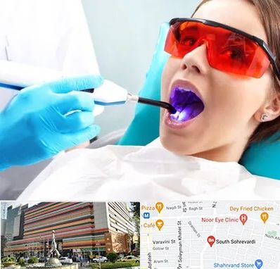 جراحی لثه با لیزر در سهروردی 