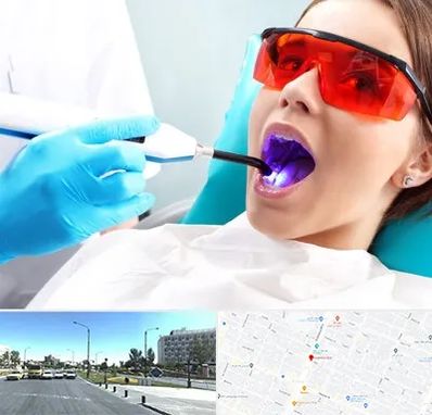 جراحی لثه با لیزر در بلوار کلاهدوز مشهد