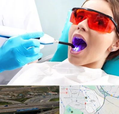 جراحی لثه با لیزر در یاغچیان تبریز