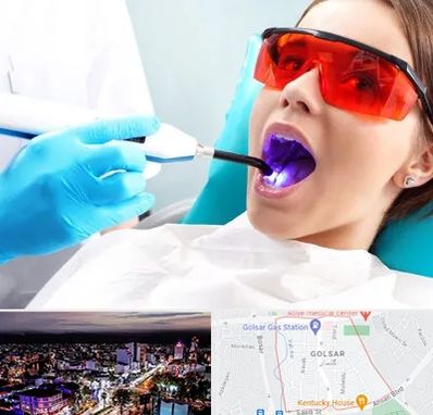 جراحی لثه با لیزر در گلسار رشت 
