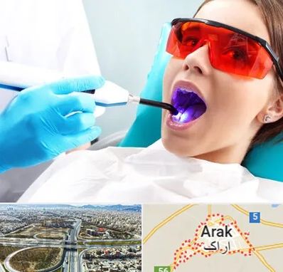 جراحی لثه با لیزر در اراک