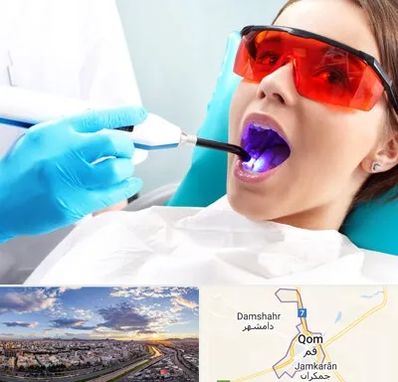 جراحی لثه با لیزر در قم