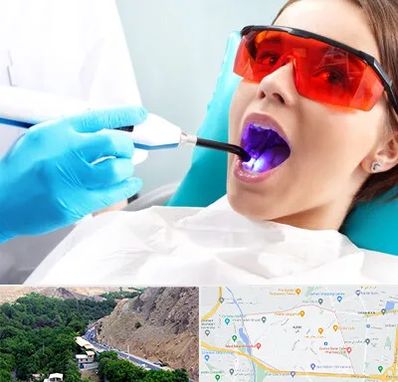 جراحی لثه با لیزر در کن