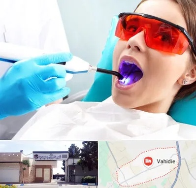 جراحی لثه با لیزر در وحیدیه شهریار