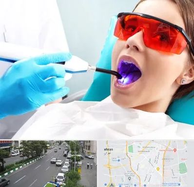 جراحی لثه با لیزر در ستارخان 