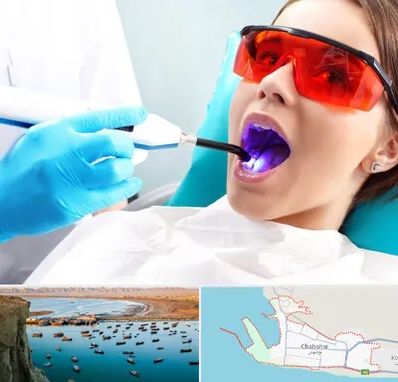 جراحی لثه با لیزر در چابهار