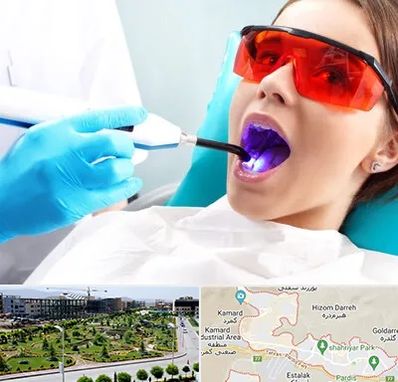 جراحی لثه با لیزر در پردیس