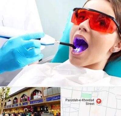 جراحی لثه با لیزر در 15 خرداد