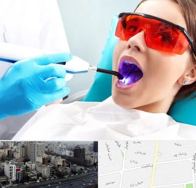 جراحی لثه با لیزر در زرتشت