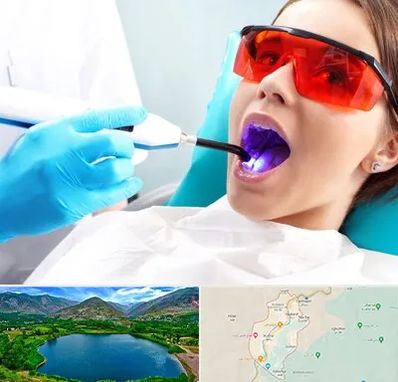 جراحی لثه با لیزر در رودبار