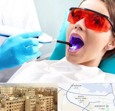 جراحی لثه با لیزر در جنوب غرب تهران