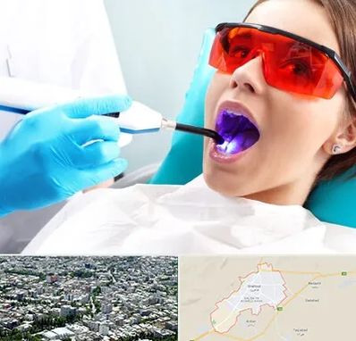 جراحی لثه با لیزر در شاهرود