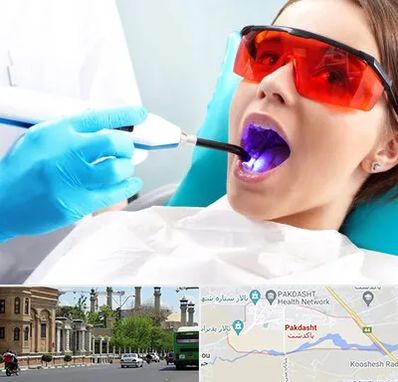 جراحی لثه با لیزر در پاکدشت