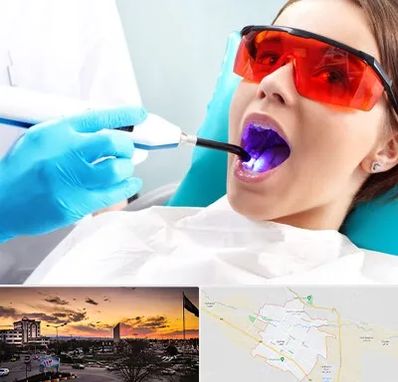 جراحی لثه با لیزر در قوچان