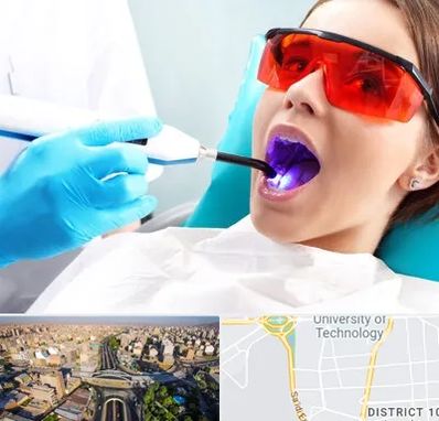 جراحی لثه با لیزر در استاد معین 