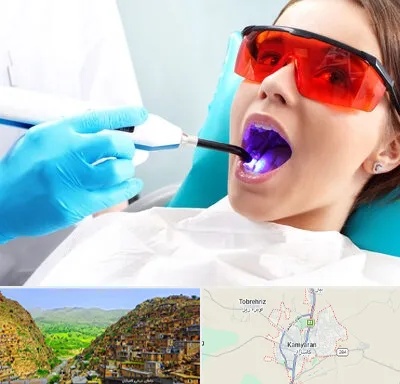 جراحی لثه با لیزر در کامیاران