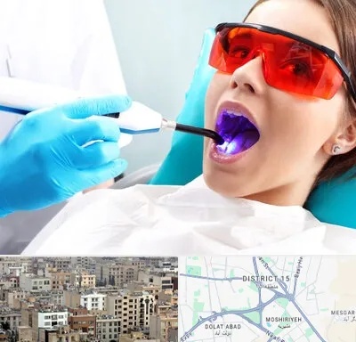 جراحی لثه با لیزر در جنوب شرق تهران