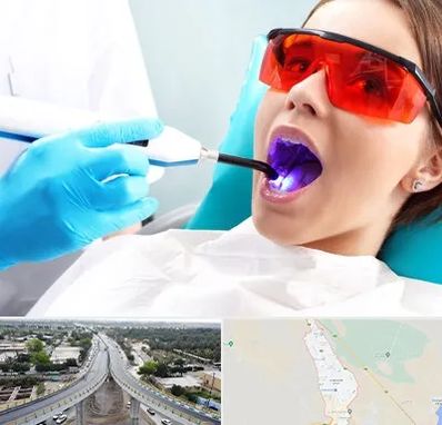 جراحی لثه با لیزر در اندیمشک