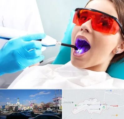 جراحی لثه با لیزر در ماهدشت کرج