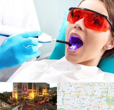 جراحی لثه با لیزر در جنت آباد تهران 