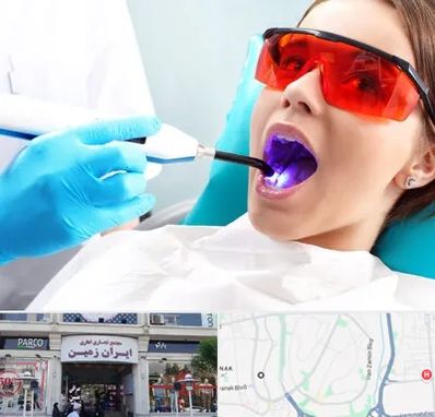 جراحی لثه با لیزر در ایران زمین