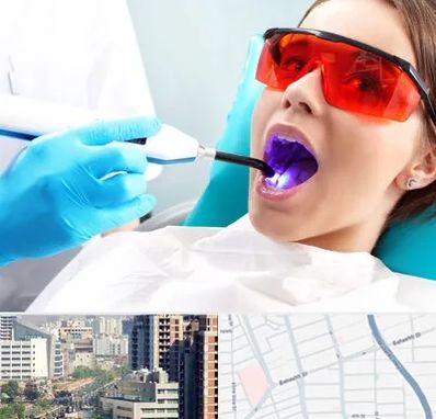 جراحی لثه با لیزر در خیابان بهشتی