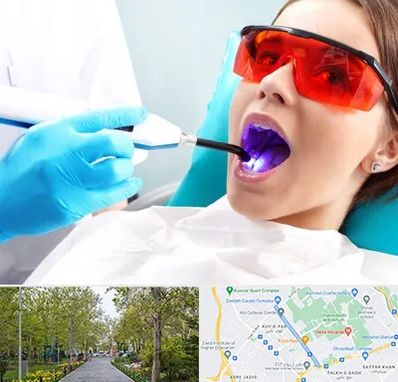 جراحی لثه با لیزر در قدوسی غربی شیراز