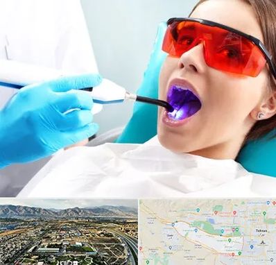 جراحی لثه با لیزر در منطقه 21 تهران