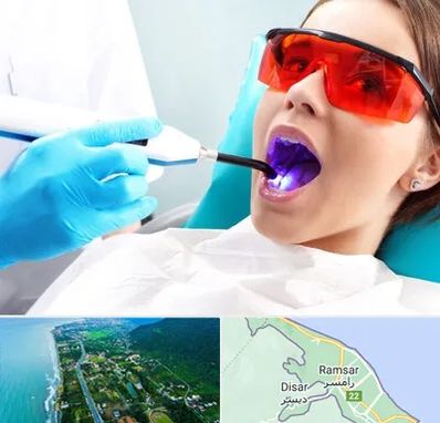 جراحی لثه با لیزر در رامسر