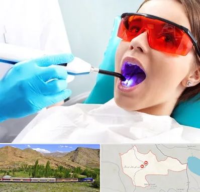 جراحی لثه با لیزر در خاش