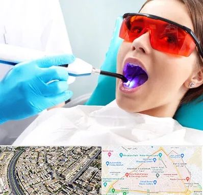 جراحی لثه با لیزر در شهرک غرب مشهد