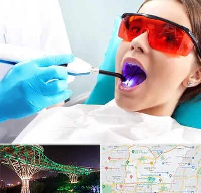 جراحی لثه با لیزر در منطقه 3 تهران